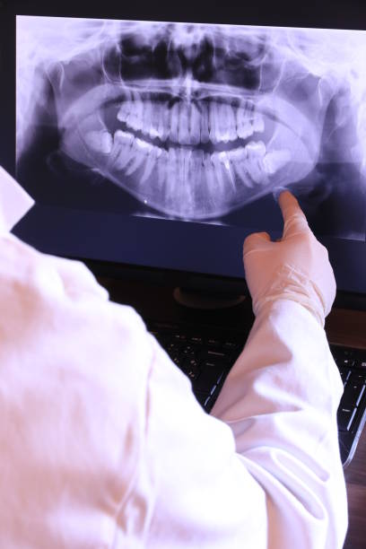 Best Emergency Tooth Extraction  in Avon, MN