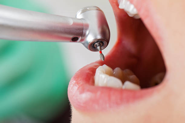 Best Cracked Tooth Emergency Dentist  in Avon, MN